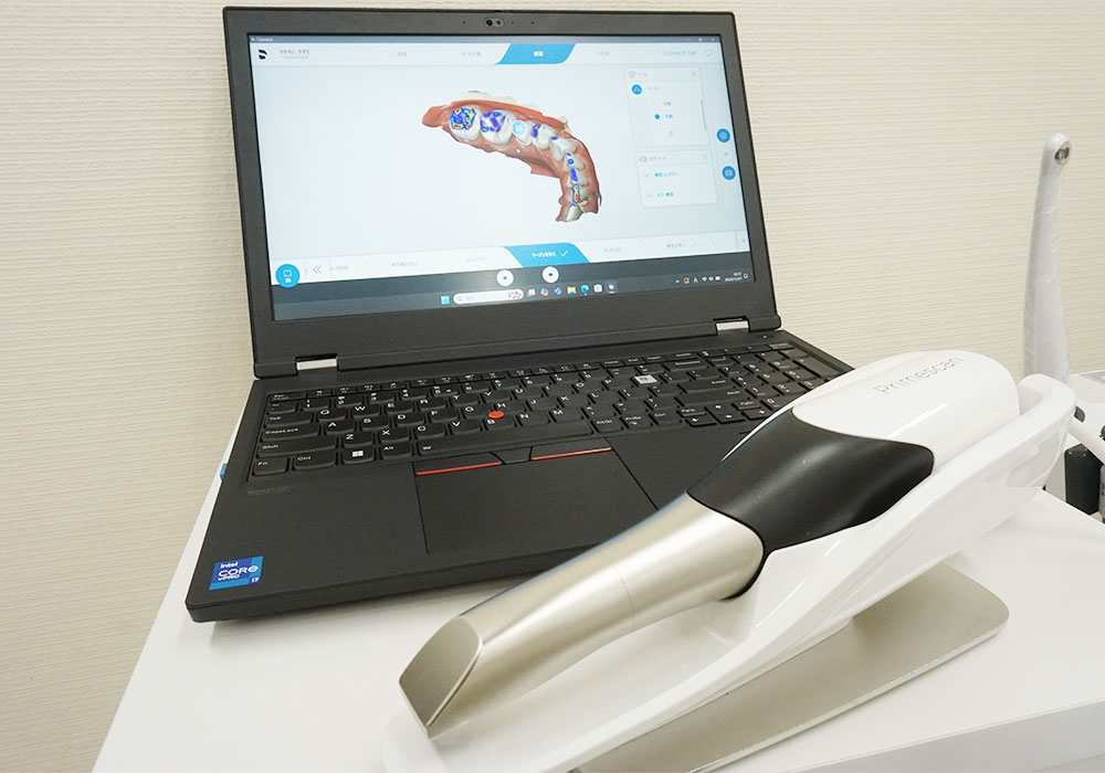 口腔内スキャナー